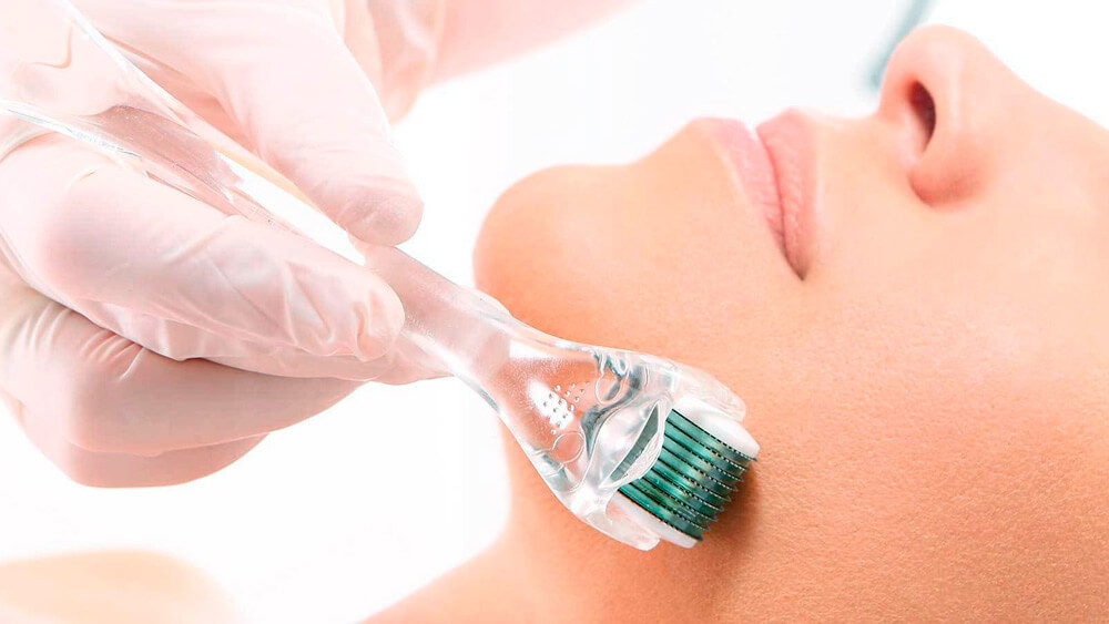 Derma roller treatment great skin results