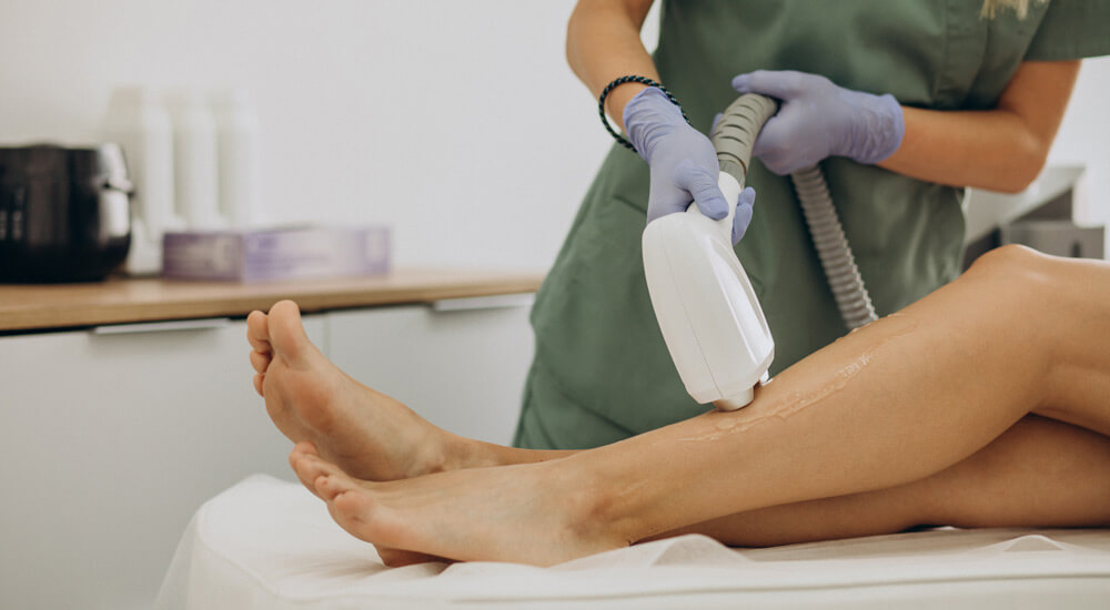 Off-season laser hair removal