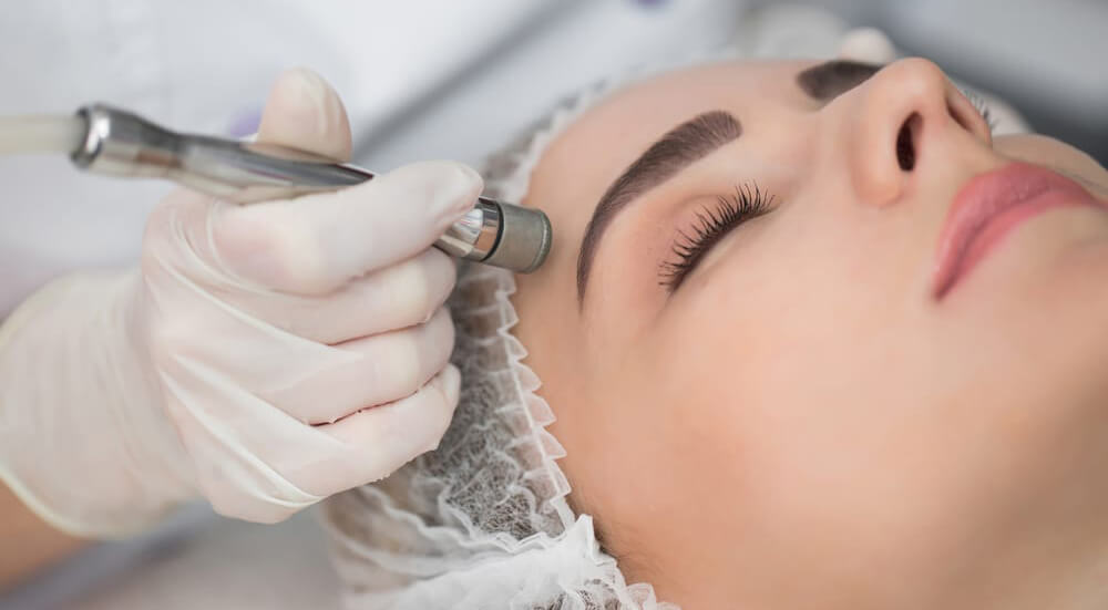 What is Microdermabrasion treatment?