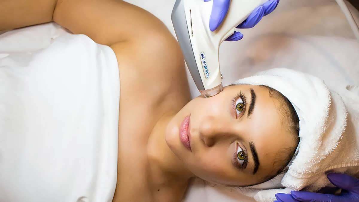 Sublative laser vs microneedling