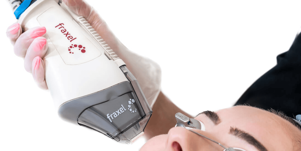 Fraxel laser treatment