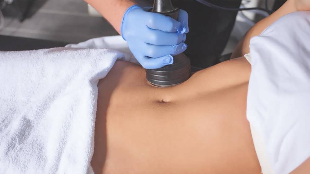 coolsculpting