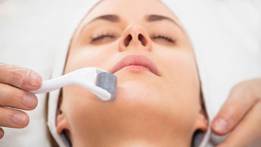 Roller microneedle mesotherapy