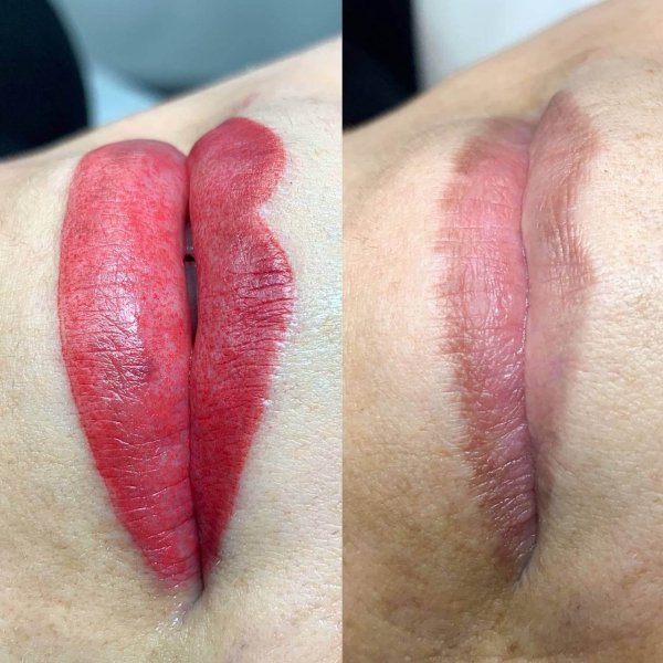 Lip Contour - Image 3