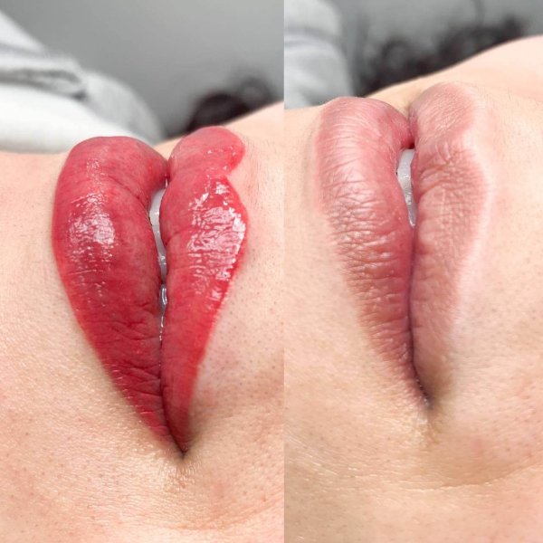 Lip Contour - Image 4