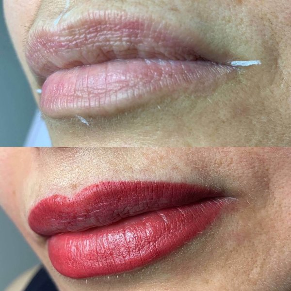 Lip Contour - Image 5
