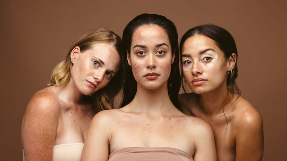 Skin problems can be caused by stress