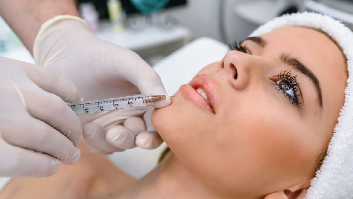 Beauty treatment with dermal fillers