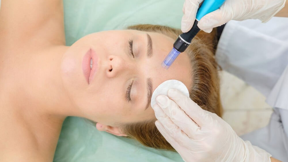 Cosmetologist making microneedling