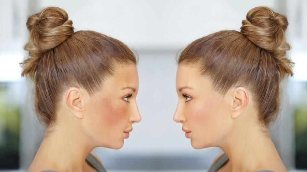 Dark spots freckles hyperpigmentation after treatment