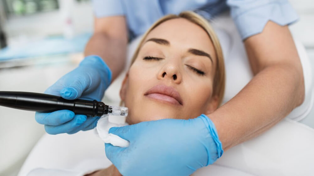 Young woman gets microneedling