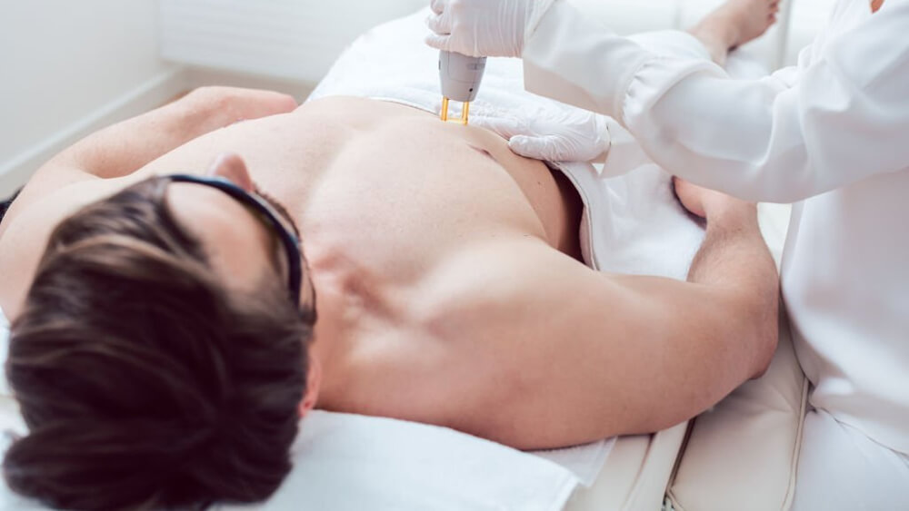 Cosmetologist using laser to remove chest hair of a man
