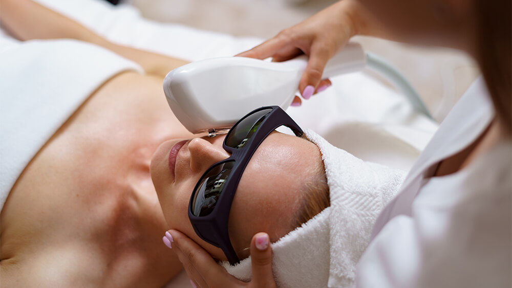 Process of IPL treatment on a woman's face