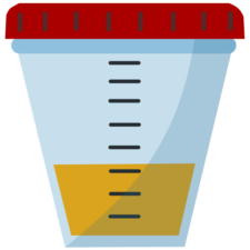 urinalysis