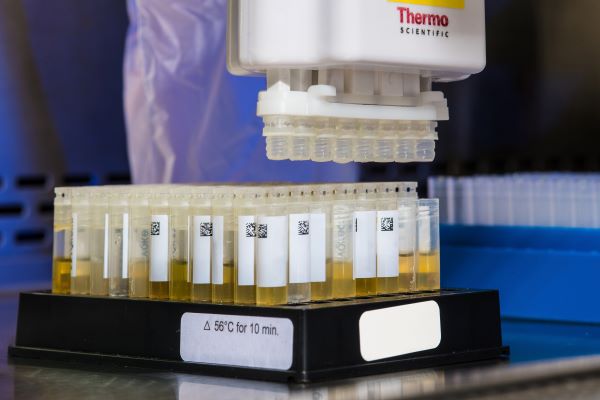 urinalysis drug testing advantages and disadvantages in Canada